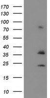 Asparagine synthetase (ASNS) antibody