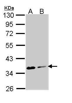 Aspartoacylase antibody
