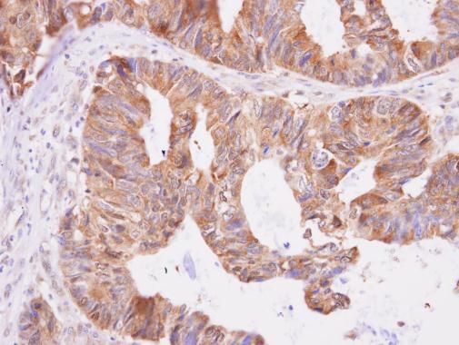 Aspartyl aminopeptidase Rabbit Polyclonal Antibody