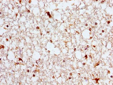 ASPH Antibody