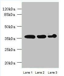 ASPHD2 antibody