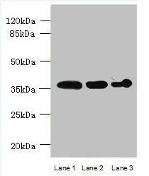 ASPHD2 Antibody