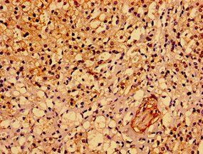 ASPM Antibody