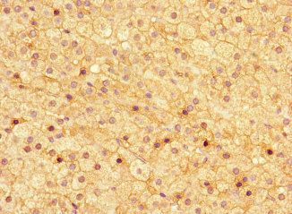 ASPN Antibody