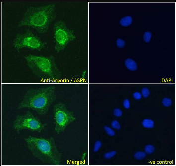 Goat anti-Asporin / ASPN Antibody