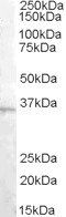 Goat anti-ASRGL1 / ALP Antibody