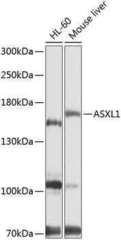 ASXL1 antibody