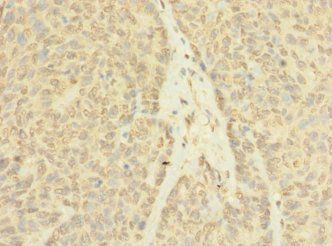 ASZ1 antibody