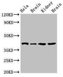 ATAD1 Antibody