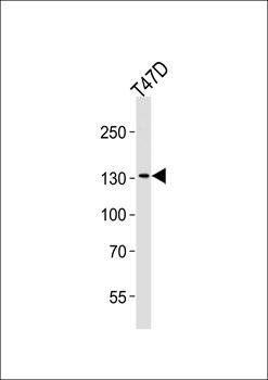 ATAD2 antibody