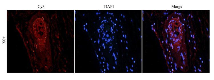 ATAD2 Rabbit Polyclonal Antibody