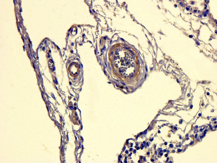 ATAD2 Antibody