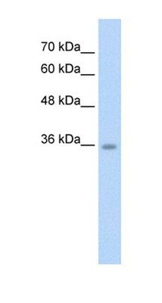 ATAT1 antibody