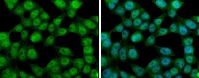 Ataxin 3 antibody