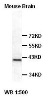 Ataxin 3 antibody