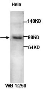 Ataxin 7 Rabbit Polyclonal Antibody