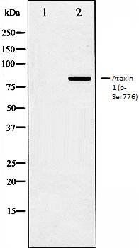 Ataxin 1 (phospho-Ser776) antibody
