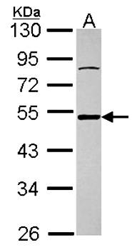 Ataxin 3 antibody