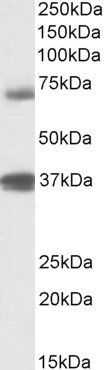 Goat anti-TRIM29 / ATDC Antibody