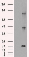 ATF 4 (ATF4) antibody