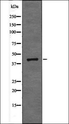 ATF-4 (Phospho-Ser219) antibody