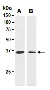 ATF1 antibody