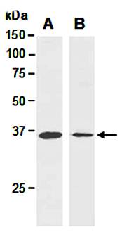 ATF1 antibody pair