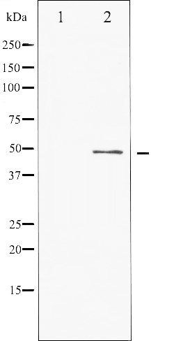 ATF2 (Phospho-Ser62 or 44) antibody