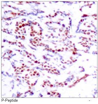 ATF2 (Phospho-Ser112 or 94) Antibody