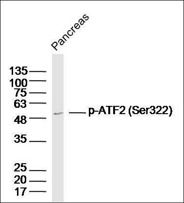ATF2 (phospho-Ser322) antibody