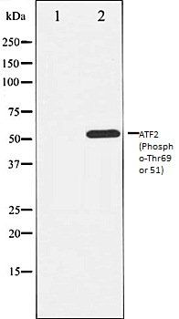 ATF2 (Phospho-Thr69 or 51) antibody