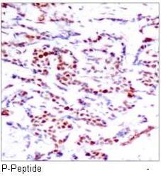 ATF2 (Phospho-Thr71 or 53) Antibody