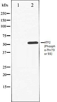 ATF2 (Phospho-Thr73 or 55) antibody