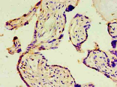ATF3 Antibody
