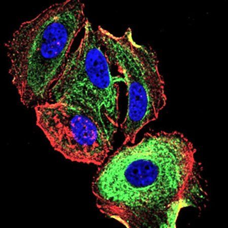 ATF3 Antibody