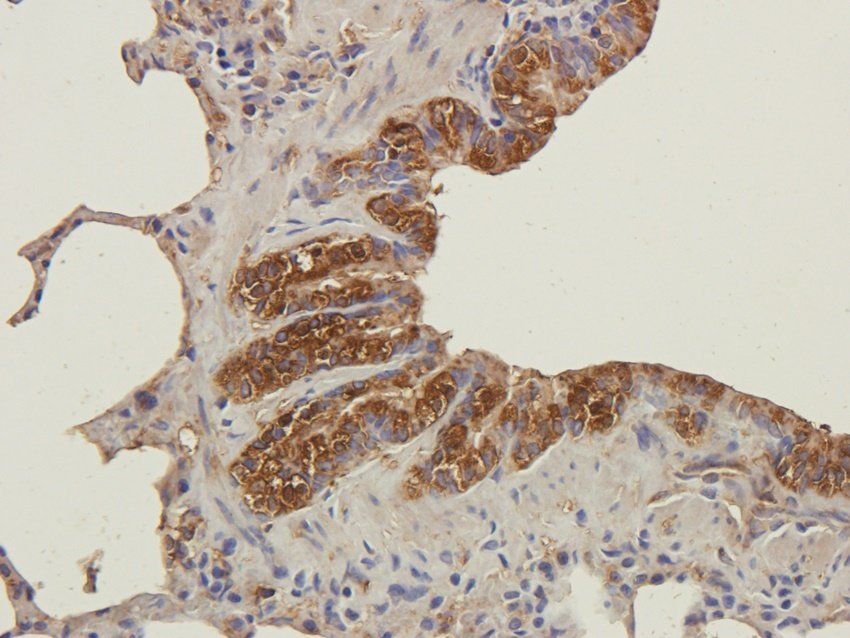 ATF4 antibody