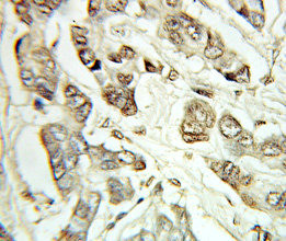 ATF4 Antibody