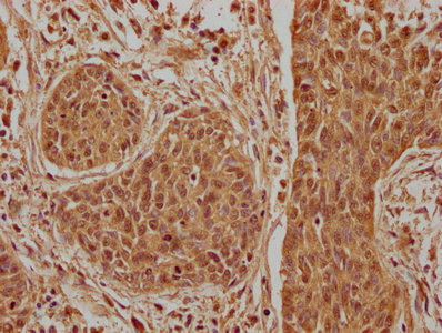 ATF5 Antibody