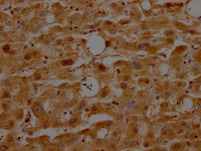 ATF5 Recombinant Monoclonal Antibody