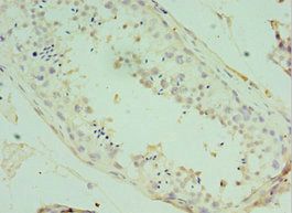 ATF7 Antibody