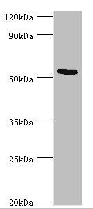 ATF7 antibody