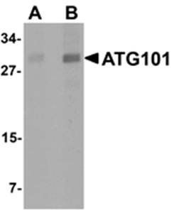 ATG101 Antibody