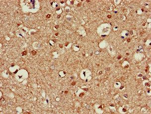 ATG13 Antibody