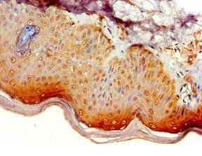 ATG14 Antibody
