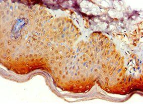 ATG14 antibody