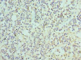 ATG16L1 antibody