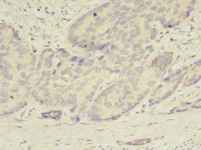 ATG2B Antibody