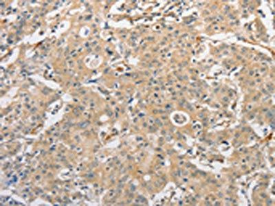ATG3 Antibody