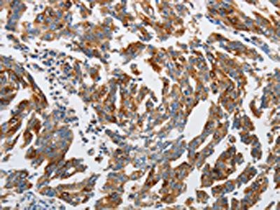 ATG4A Antibody