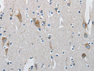 ATG4A Antibody